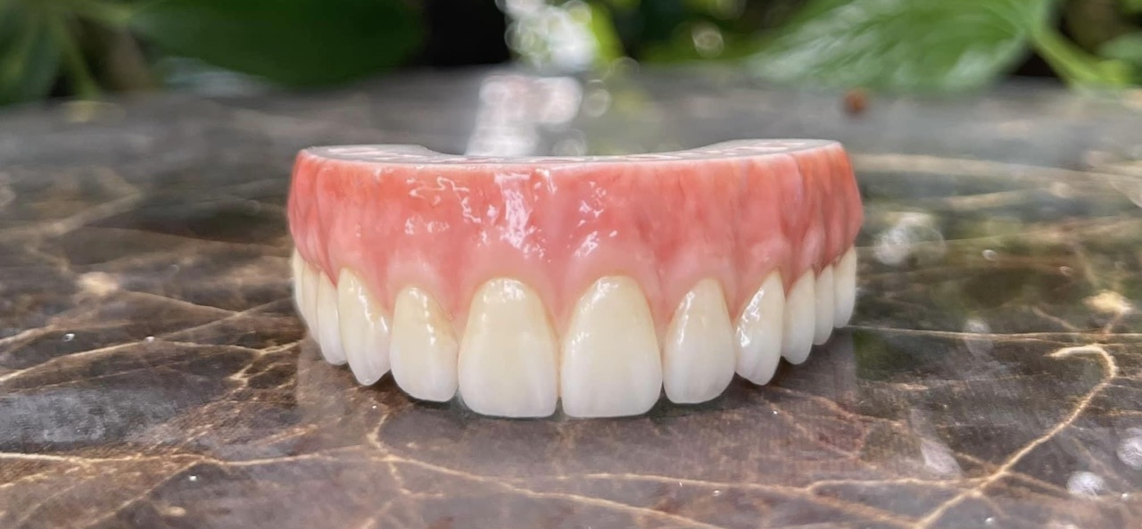 Mẫu phục hình răng sứ 11
