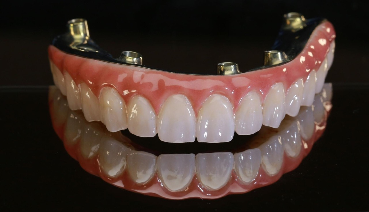 Mẫu phục hình răng sứ 12